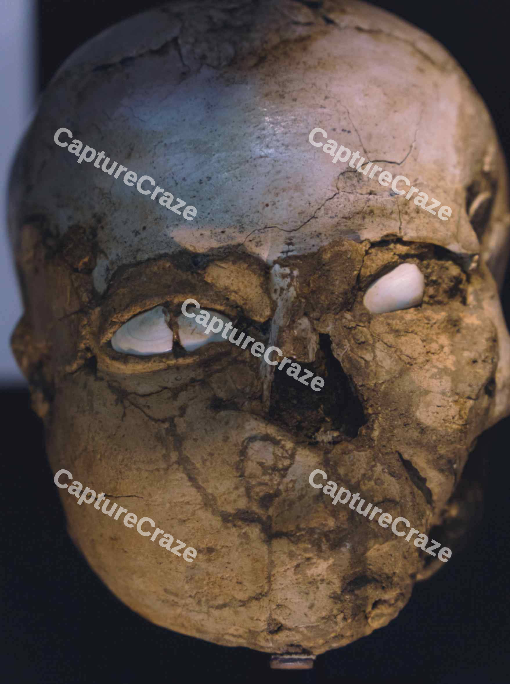 Deformed Skull